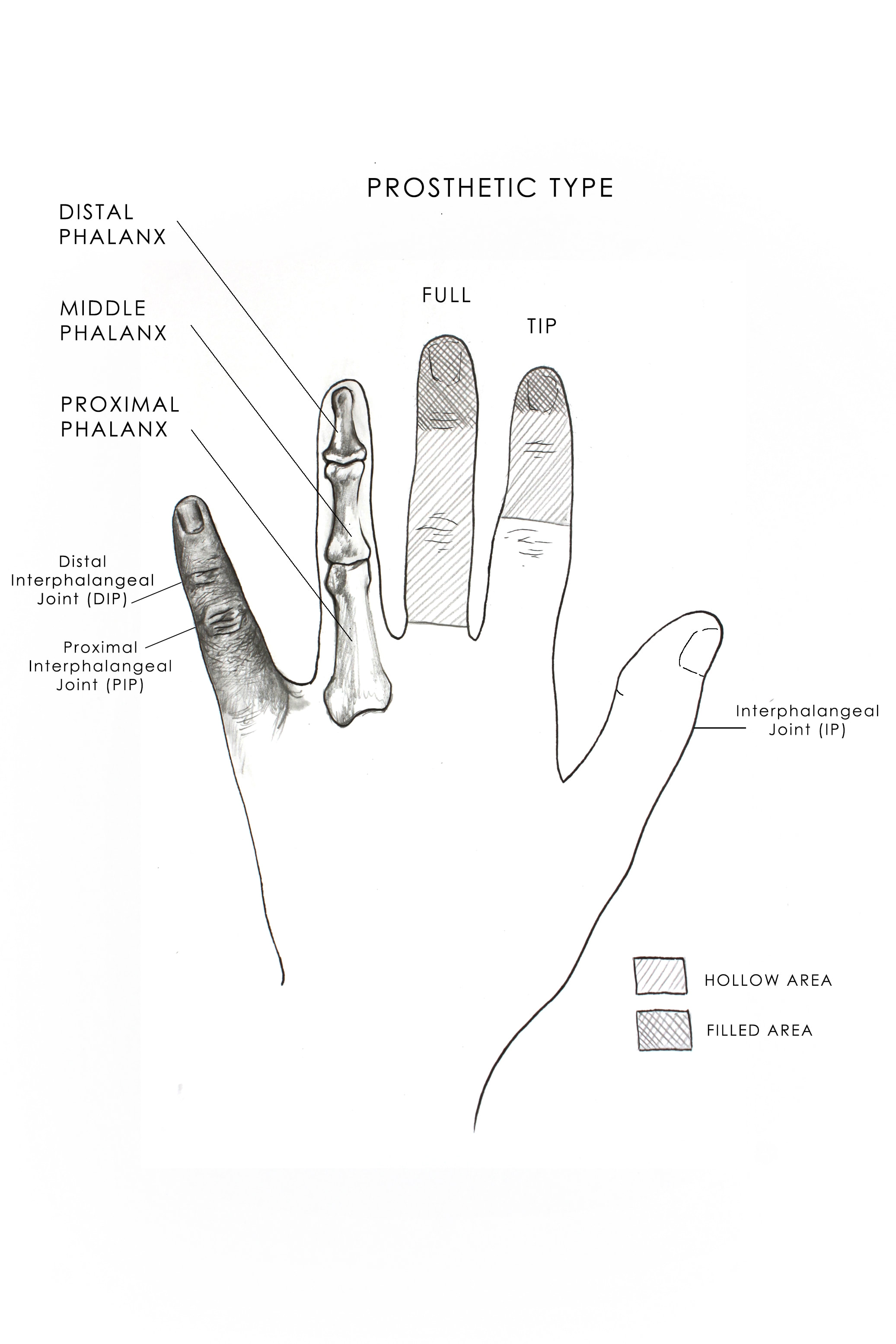 Female LOUISE model- Basic SHORT length Fingertip Prosthetic in